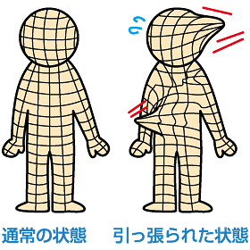 腱鞘炎